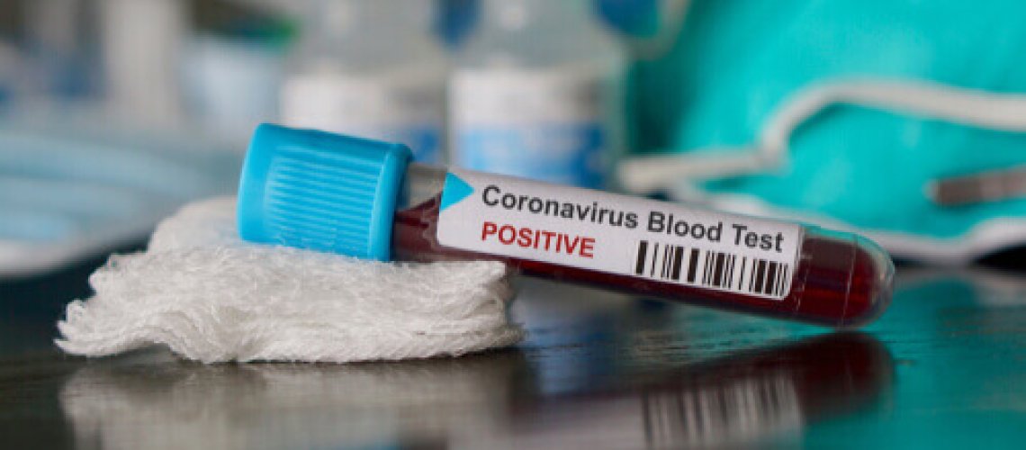 Levante Ideias - Coronavirus